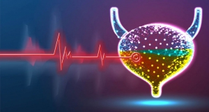 نوار مثانه