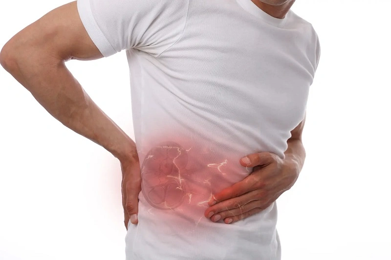 بررسی سنگ کلیه و نفخ شکم