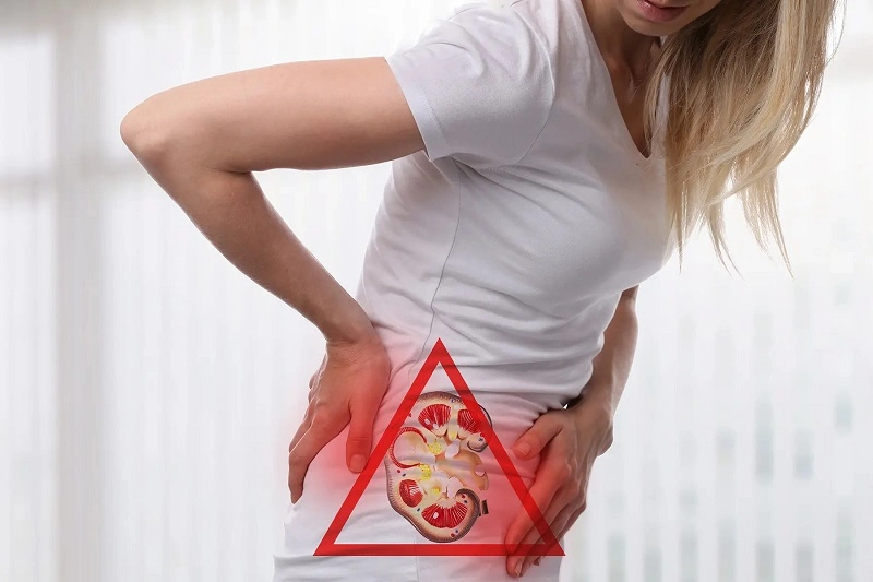 چگونگی ارتباط سنگ کلیه و نفخ شکم