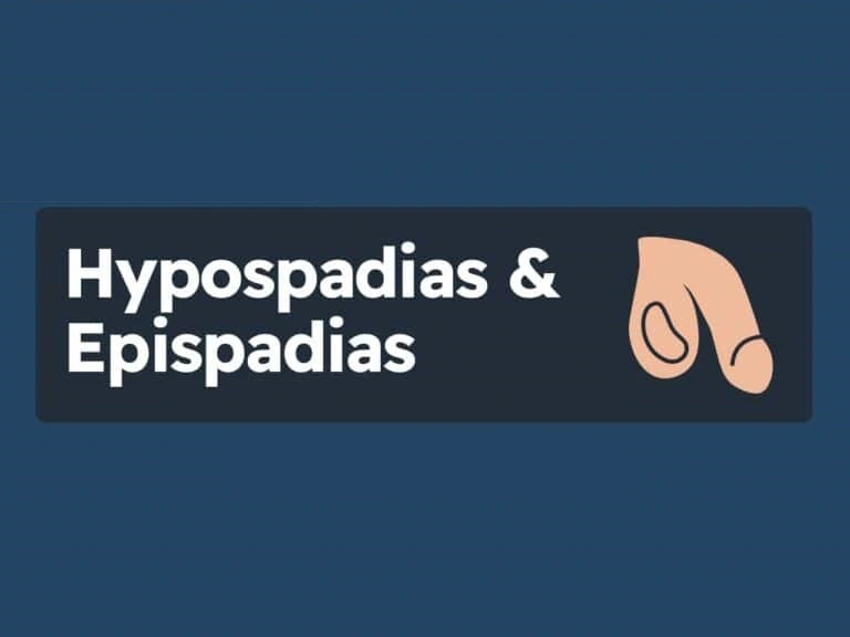 تشخیص بیماری هیپوسپادیاس و درمان Hypospadias