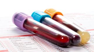 آزمایش HPV