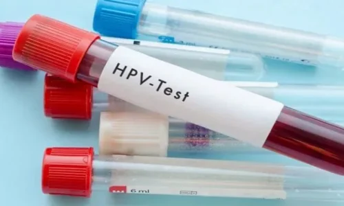 اهمیت انجام آزمایش HPV_علائم زگیل تناسلی