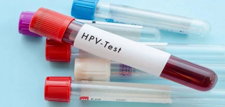 اهمیت انجام آزمایش HPV
